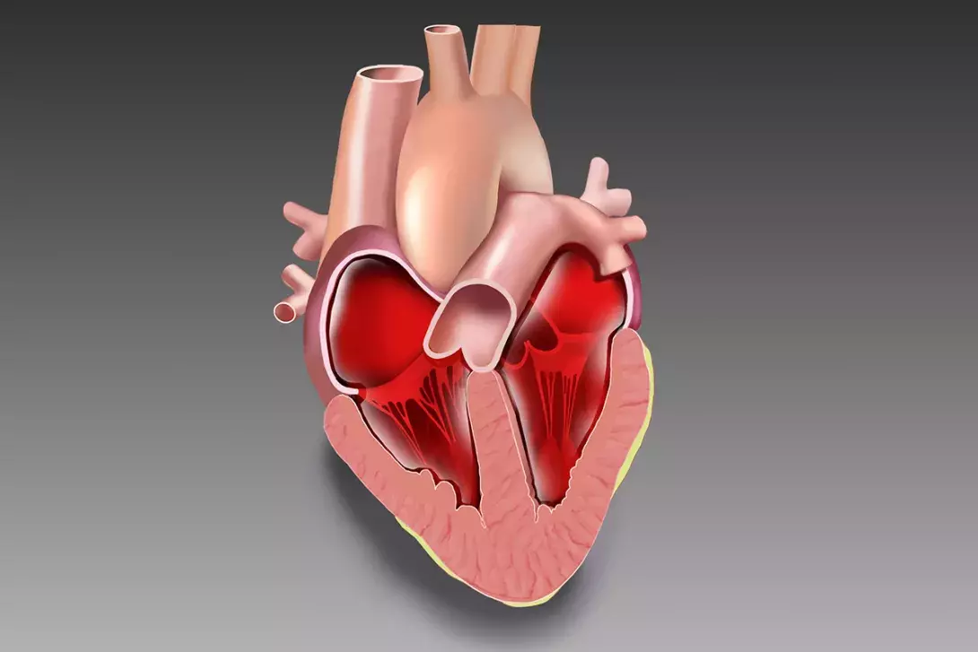 Understanding Ejection Fraction and What It Means for You