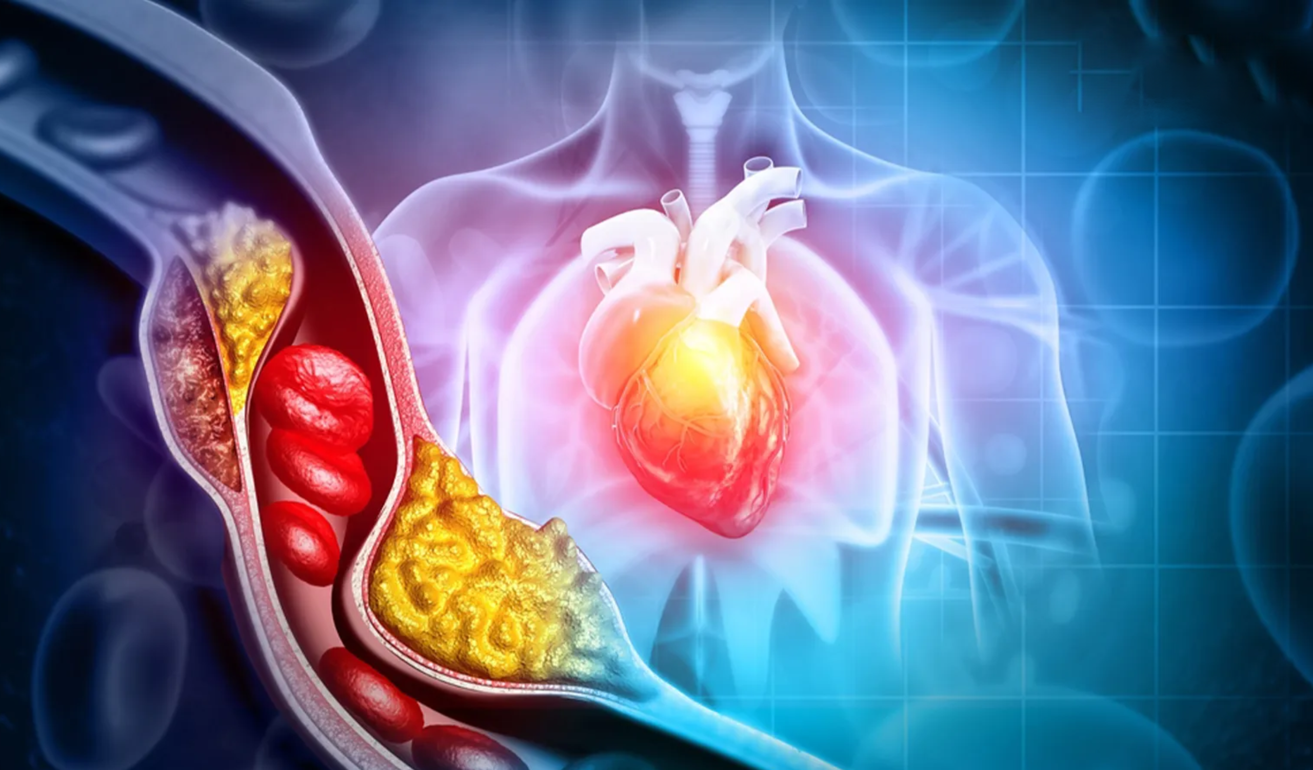 What to Know About Blood Thinners After Heart Treatment